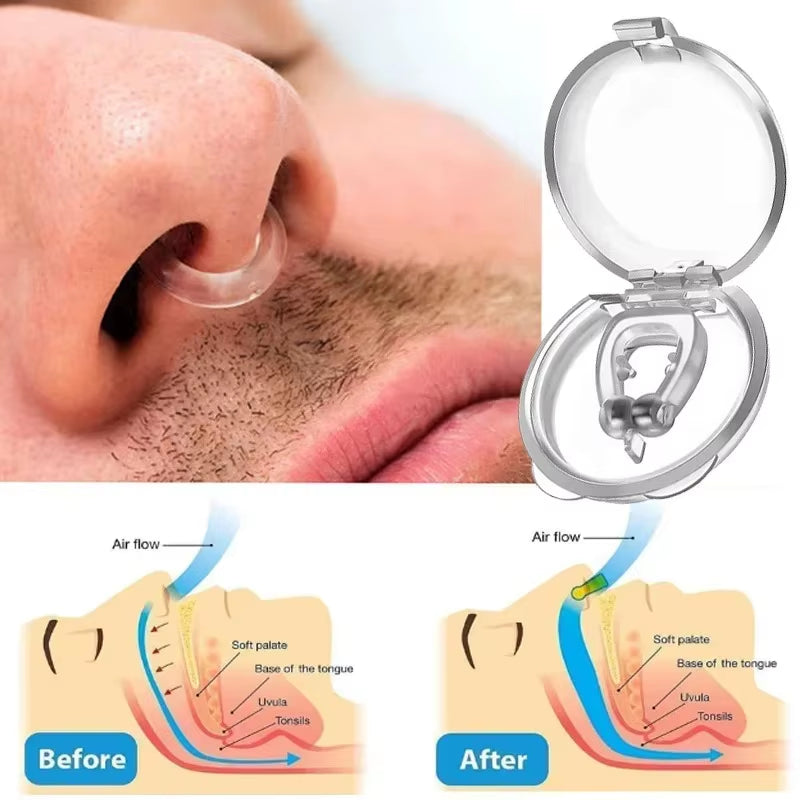 Anti-Snoring Corrector Snore Prevention Gadget Women'S Anti-Snore Device Snore Elimination Nose Clip Men'S Sleep Night