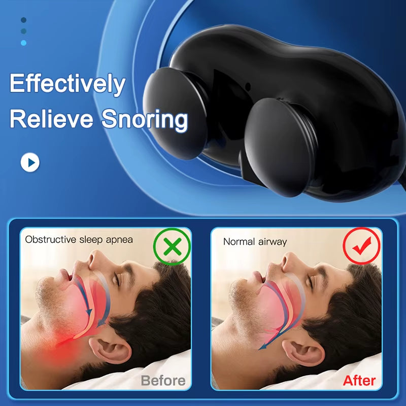 Smart anti Snoring Device Snore Stopper Snoring Solution Throat Massager Sleep Device Sleep Well Stop Snore Sleep Apnea Aid